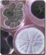 testing for mold cultures